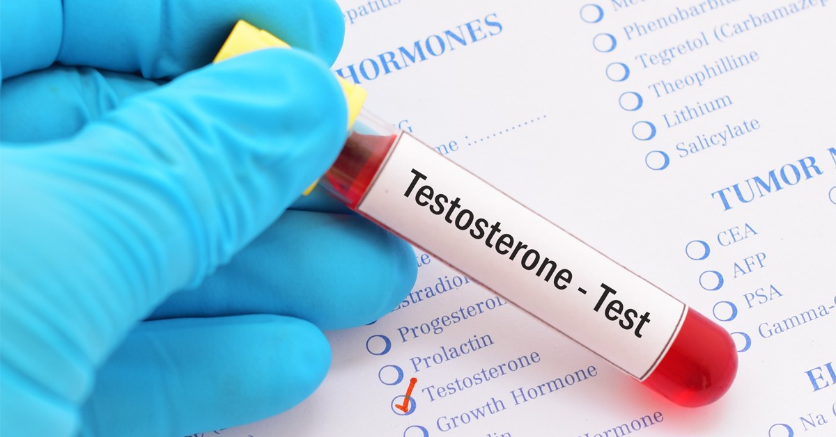 Is It Time for a Testosterone Test? Signs and Symptoms Explained